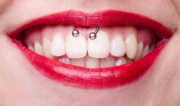 Smiley piercing